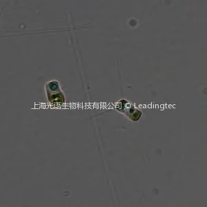 Chaetoceros debilis Cleve-40X