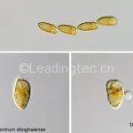 Prorocentrum donghaiense