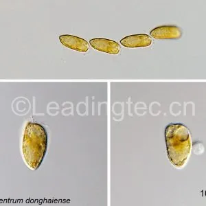 东海原甲藻(GY-H40 Prorocentrum donghaiense)