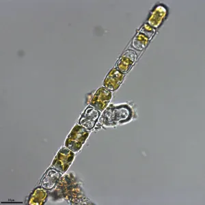 GY-H64 具槽直链藻 Melosira sulcata